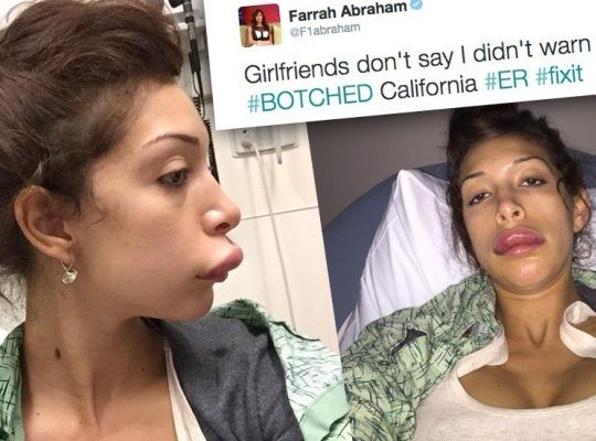 Plastic surgery gone wrong porn star edition 6 surgery2