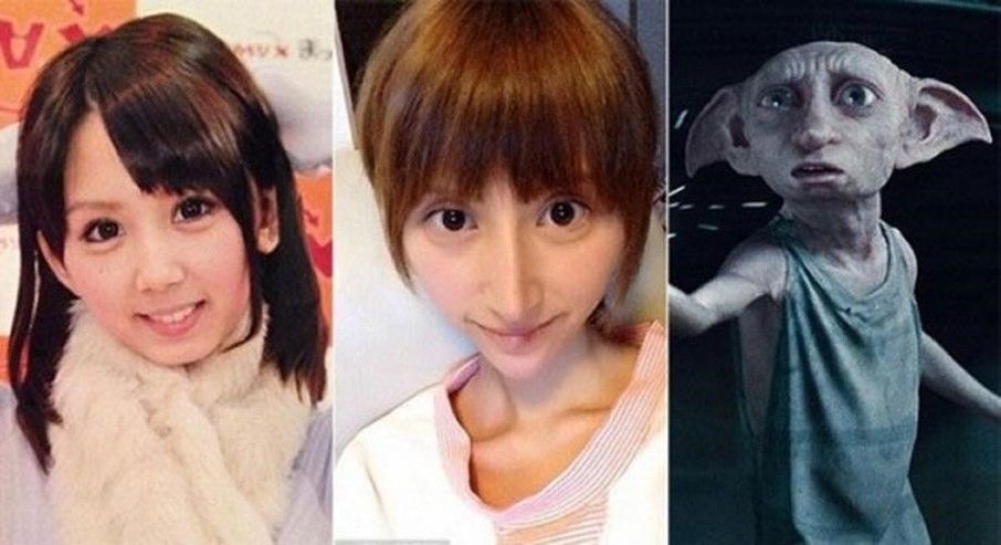Plastic surgery gone wrong porn star edition 7 surgery3