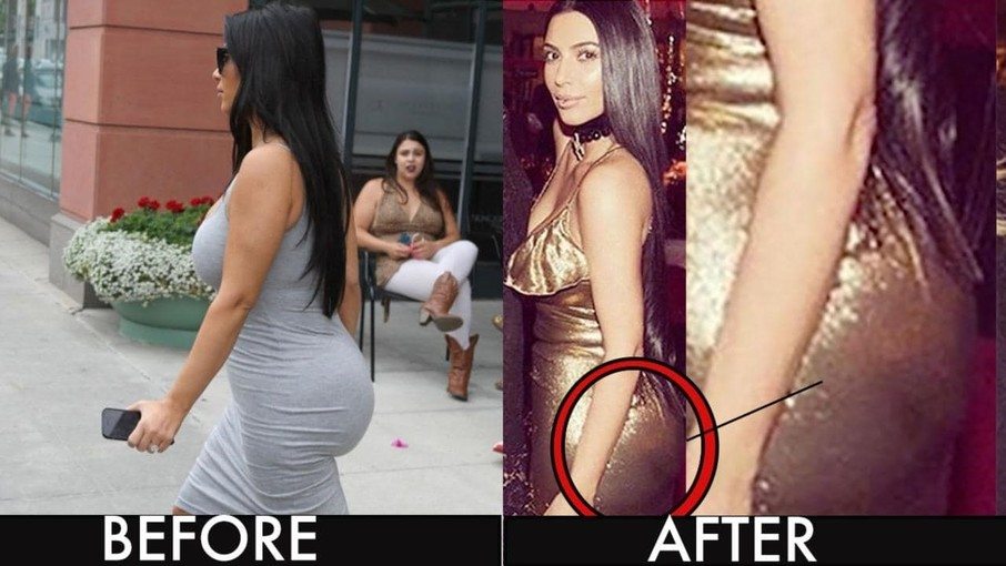 Plastic surgery gone wrong porn star edition 9 surgery5